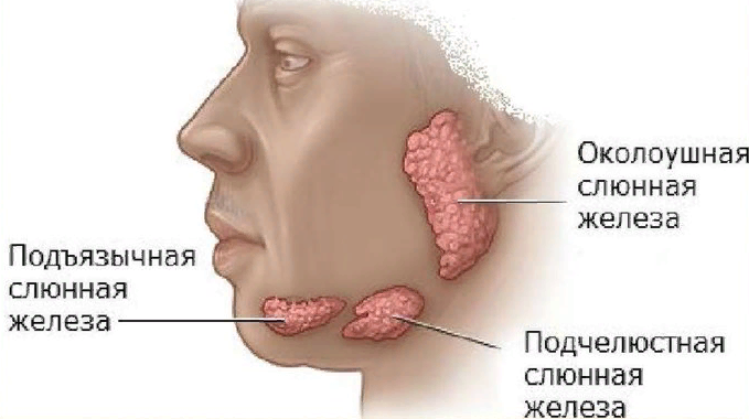 воспаление слюнной железы, воспаление околоушной слюнной железы, сиалоаденит слюнной железы, воспаление слюнного протока