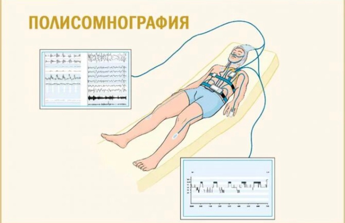 Полисомнография. Полисомнографического исследования. Полисомнограф аппарат.